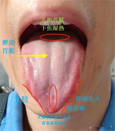 不是你失眠，颈肩痛，老盯着肾干嘛？别说吃几百的补肾药，你就是吃大几千的也不见效啊