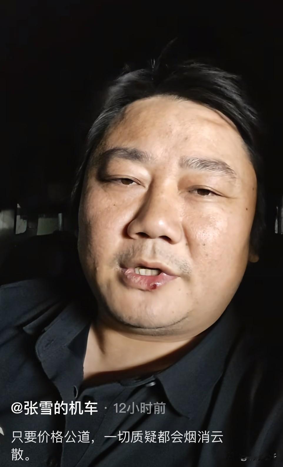 张雪凌晨针对韩红基金会相关争议，公开发表自己的看法!

他坦言，只要愿意晒出采购