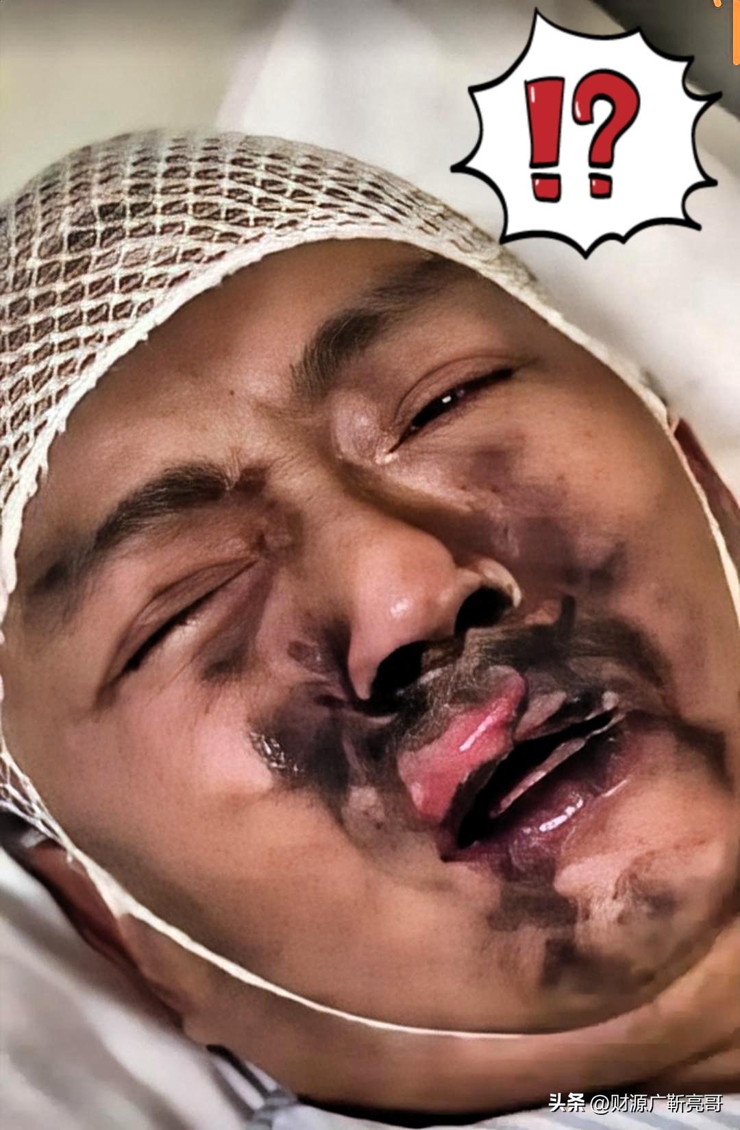 这烟瘾到底是能有多大？为了抽这一口，连命都不要了？

有个男的住院正吸着氧呢，估