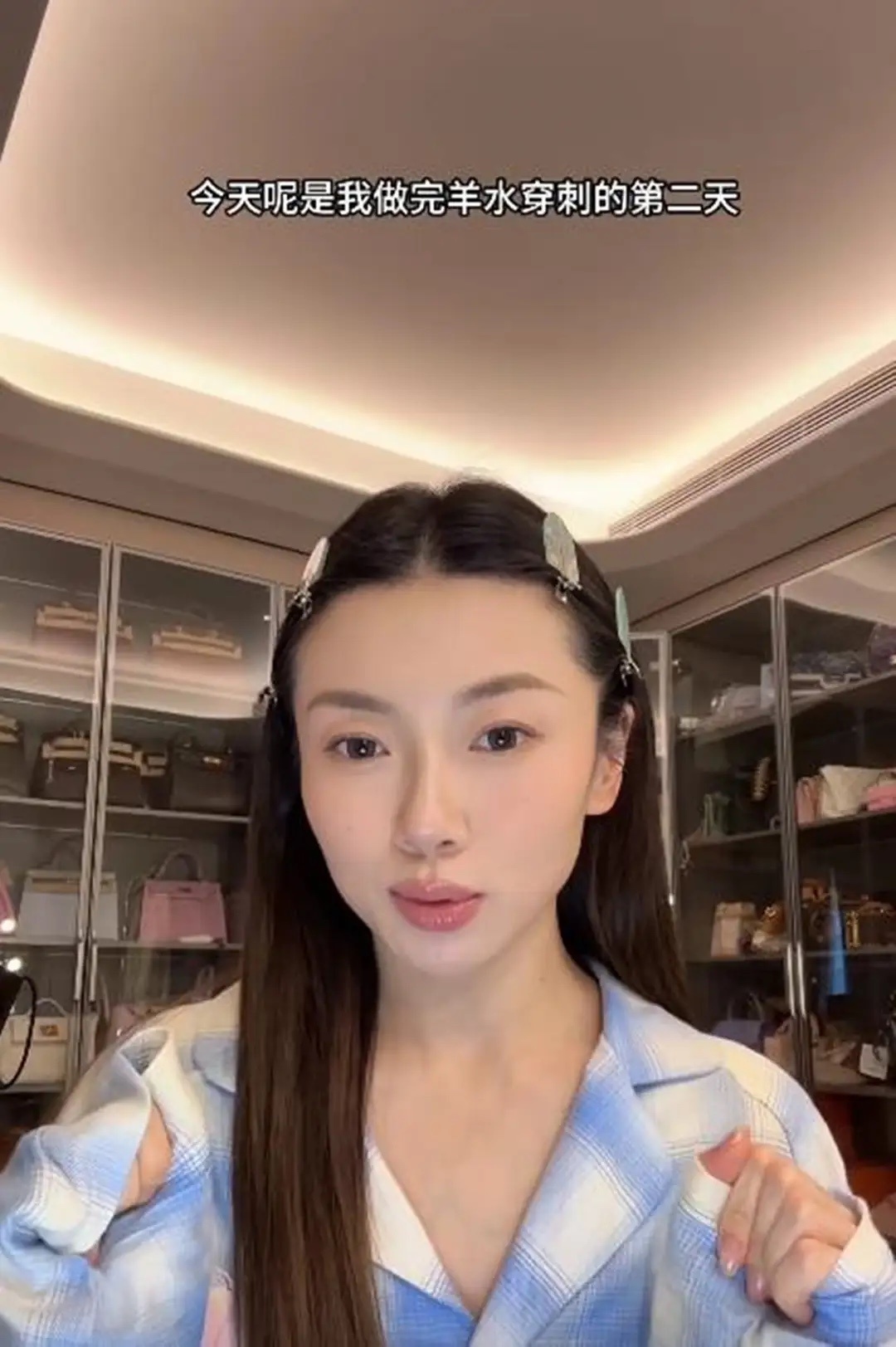 程晓玥公开做羊穿原因，NT增厚是重点，二胎还没生已经有三胎计划！！！ 