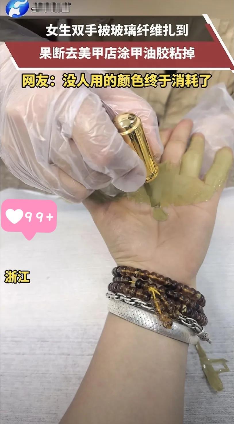 浙江一位女生被玻璃纤维扎手后的“神操作”，简直让人大开眼界！她既没硬拔也没跑医院