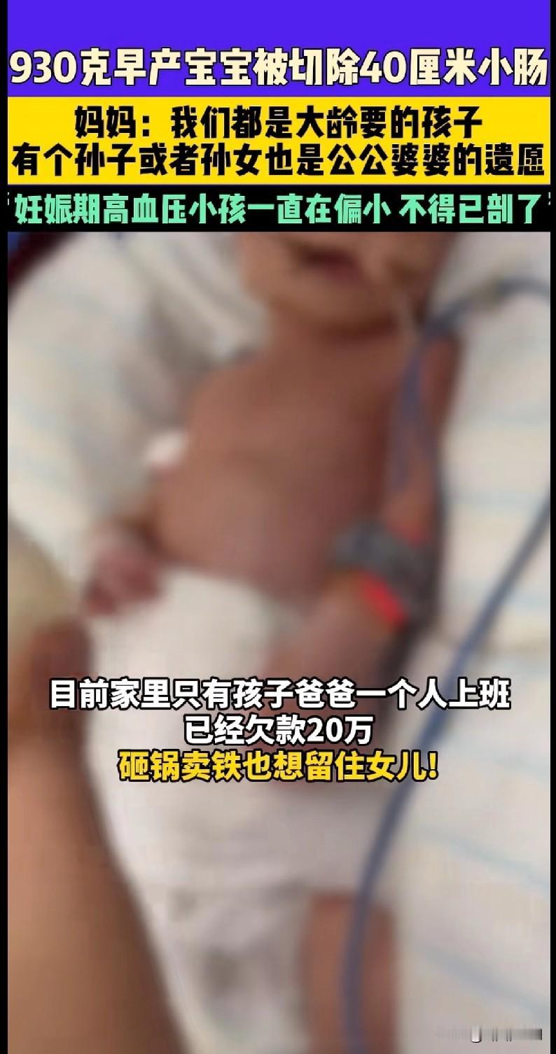 家人们，郑州这家人的故事看得人又心疼又感动！930克的早产宝宝切除了40厘米小肠