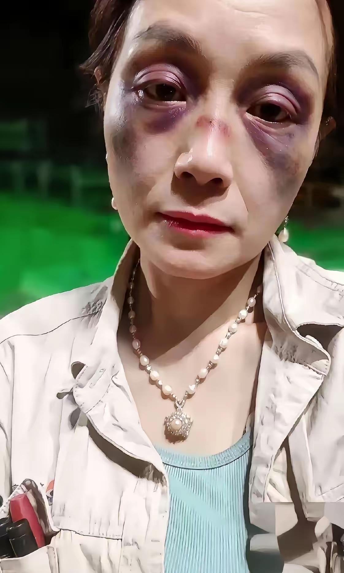 女子和男同事一起加班太晚了，下班了后出去又一起吃夜宵， 结果被男同事的妻子误会了