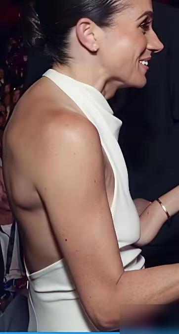 整形后的梅根鼻梁愈发高挺了，就像当年的杰克逊一样，产生了容貌焦虑。梅根一边说王室