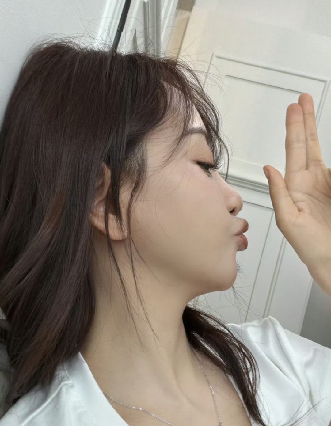 杨蓉面部烫伤恢复近照杨蓉面部烫伤事件引发关注的同时，也为公众敲响了急救知识的警钟