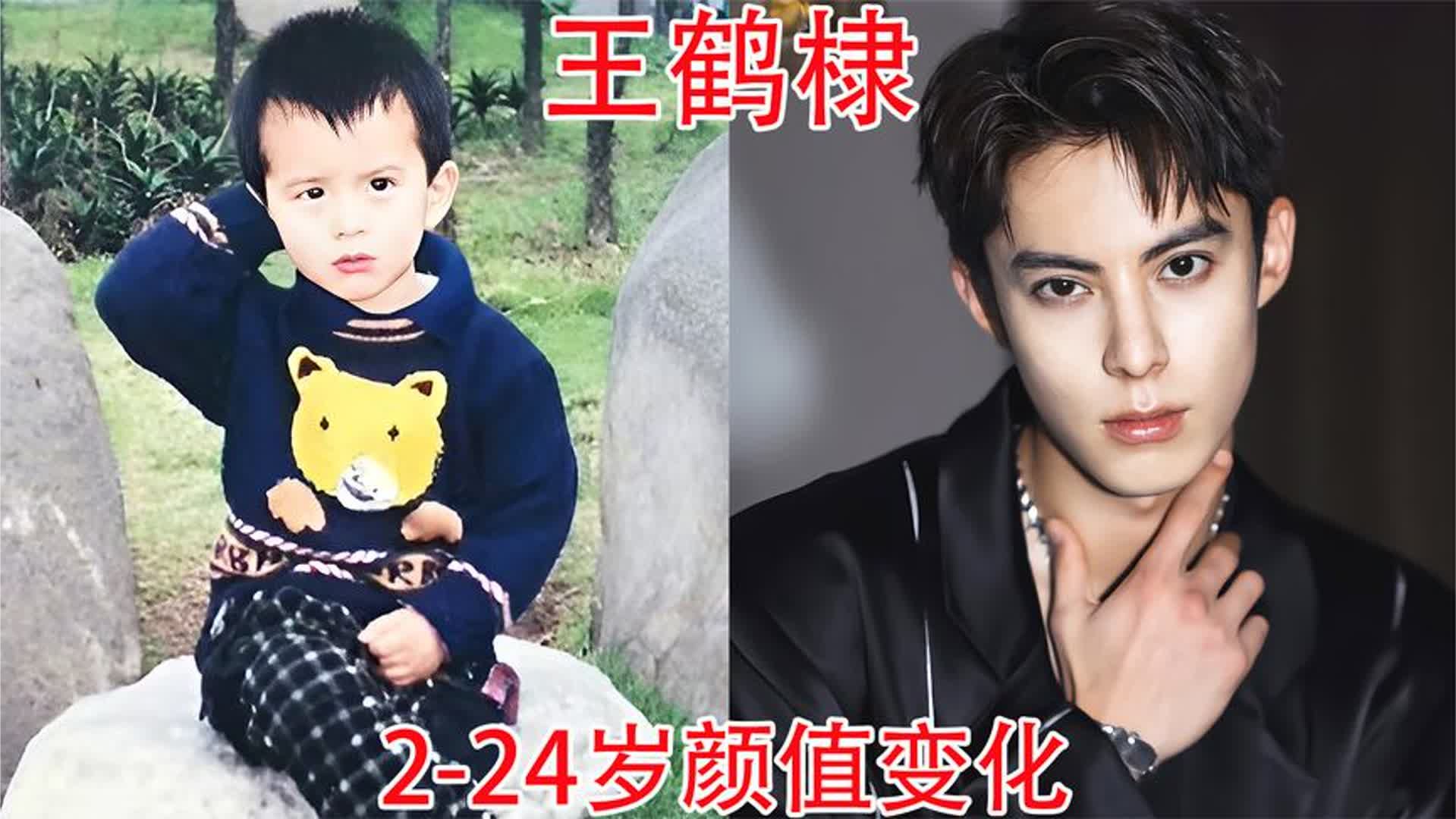 王鹤棣2-24岁颜值变化，粉丝：容颜俊美且不油腻，堪称霸总洗洁精