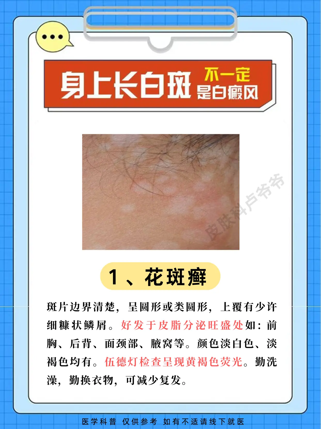 身上长白斑，这几种要分清
