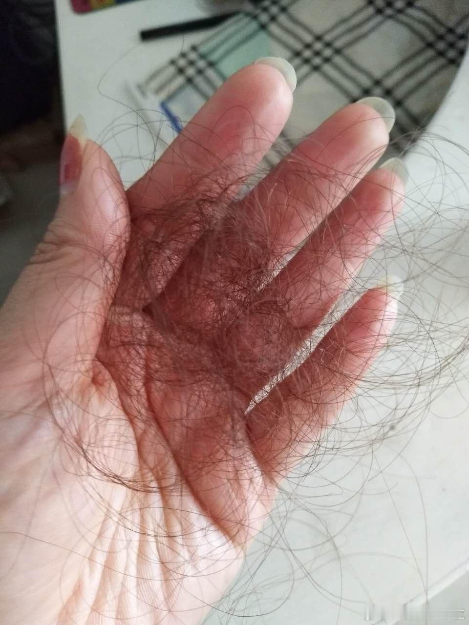 有一个客户，她以前一洗头发就掉很多头发了。然后，她吃了一段时间的花生浆蛋白和姜力