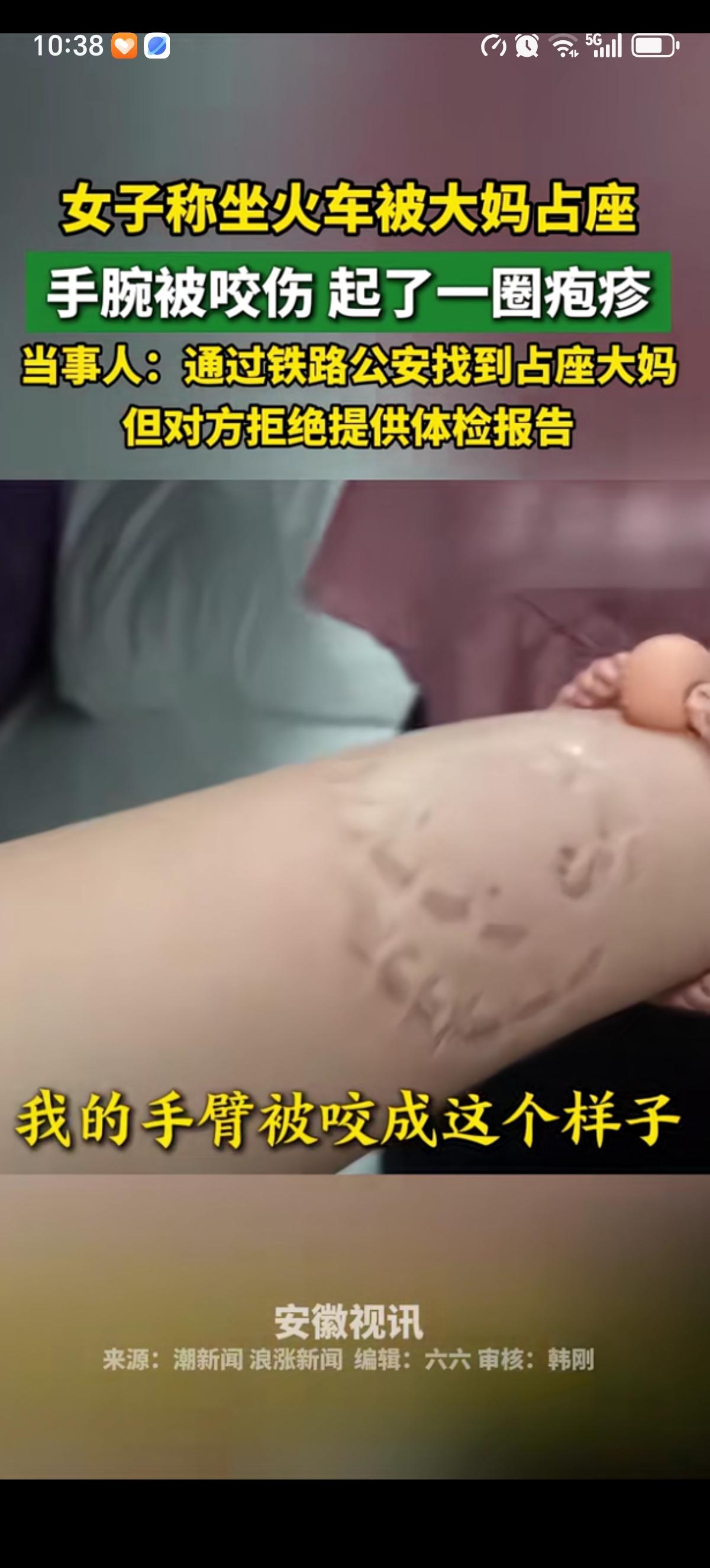 江苏李女士坐火车买的下铺被上铺的大妈占了，大妈不还座还咬李女士的胳膊不松口。被调