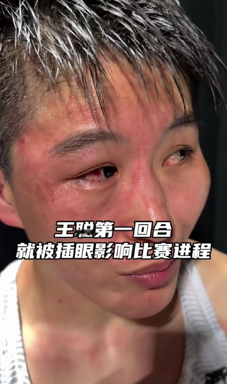 王聪赛后说第一回合后半段被对手插眼直接影响了第二回合的发挥。席尔瓦在第一第二回合