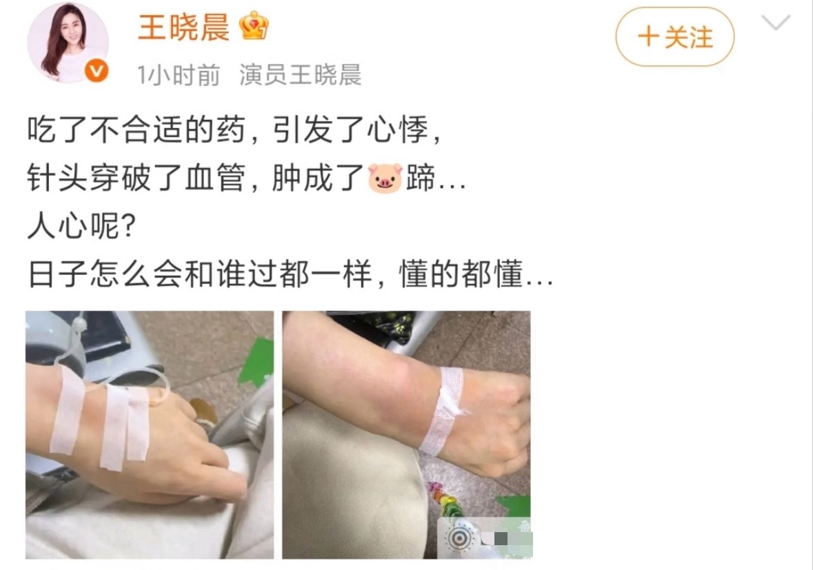 王晓晨 俞灏明就因为王晓晨发文透露，由于吃了不合适的药，引发了心悸，并晒出一组就