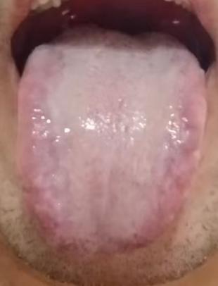 下焦湿热为何总是难以根除？会带来哪些身体困扰？






有粉丝留言倾诉：年轻