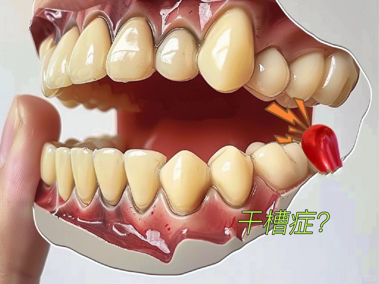 医生：我拔牙干槽症了吗？