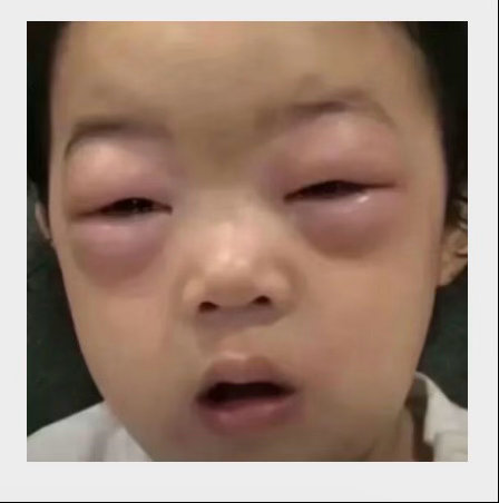 盘点那些玩手坤眼睛肿成这样的顶级瞬间 ​​​