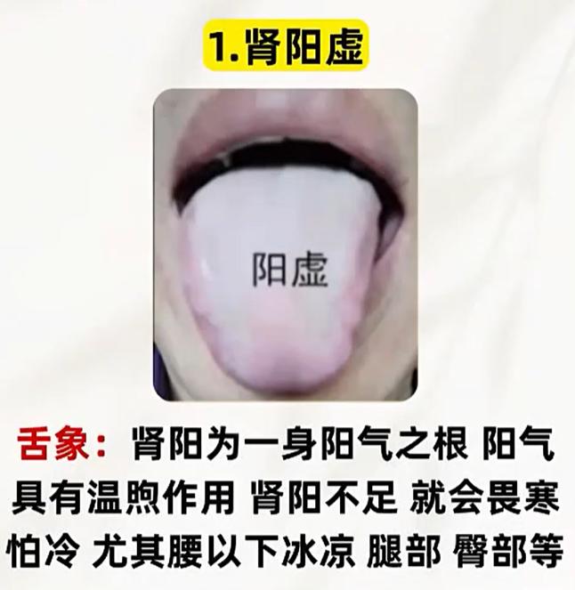 怕冷腿疼、肢体发凉，五种舌象分清阳虚寒湿与淤堵