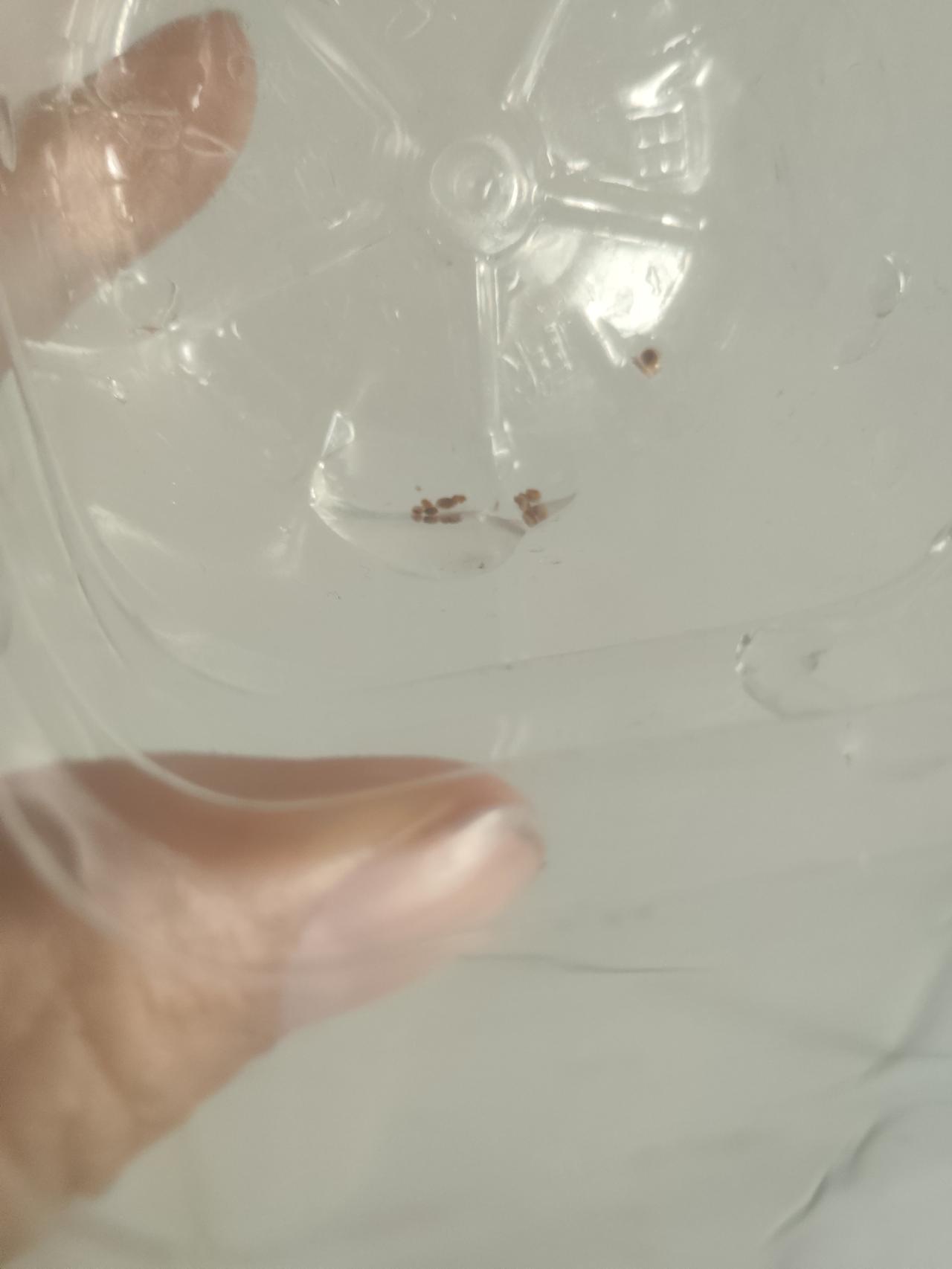 无语了，多喝水，注意高嘌呤，草酸高的食物忌口，坚持每天走八千步！

能做的几乎都