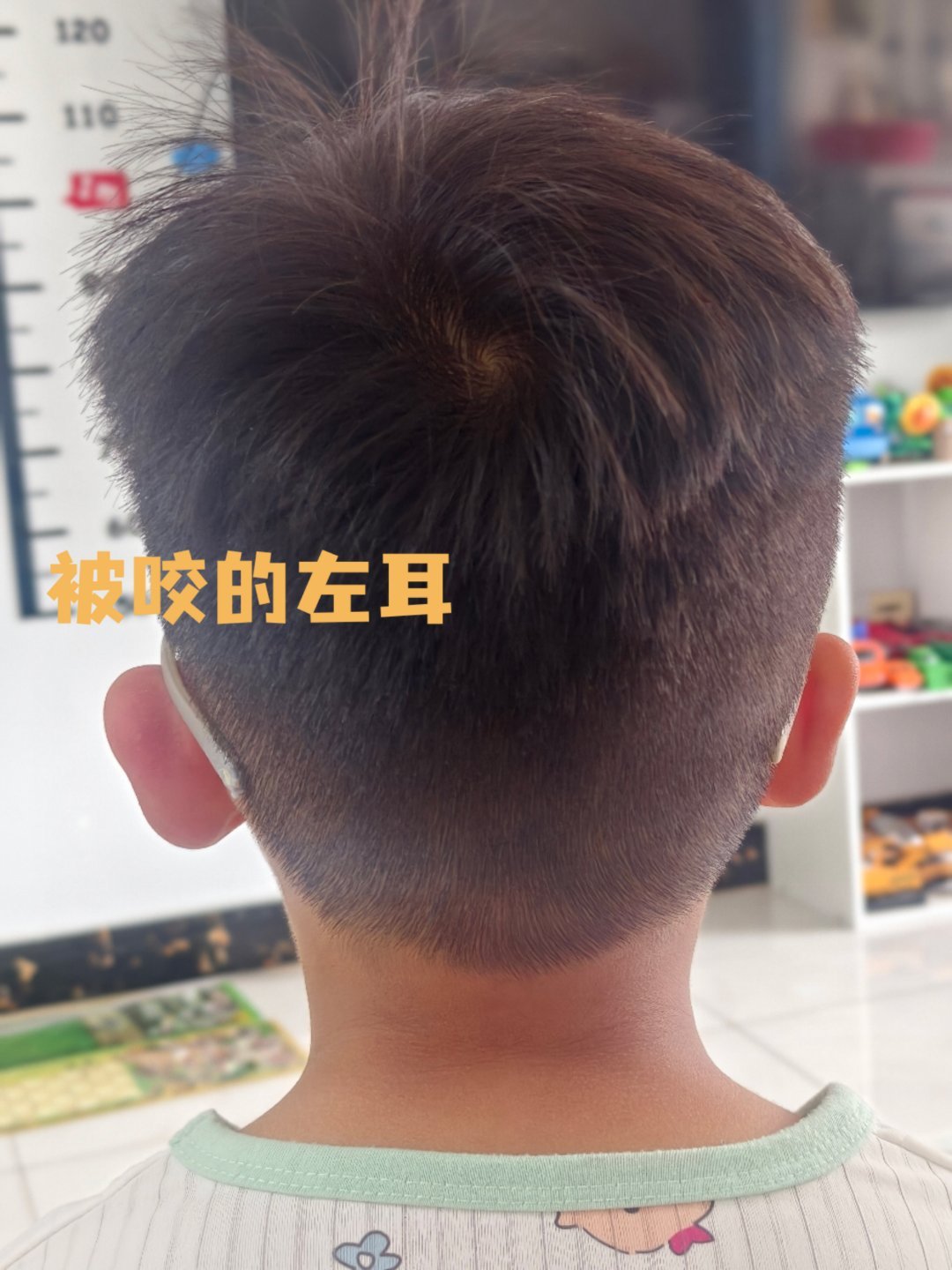 无蚊公园一家四口都是招蚊体质真的齐刷刷的举四双手表示羡慕啊这才刚刚入夏，好久没出