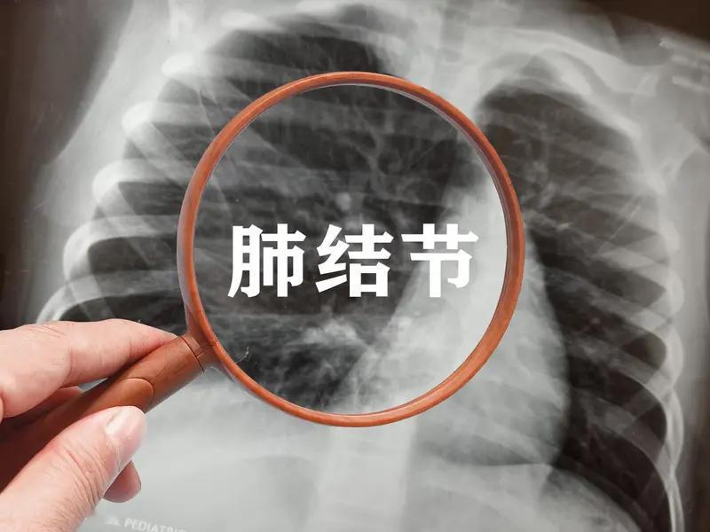 在西医看来，生气时体内会分泌一些应激激素，比如肾上腺素。大量的肾上腺素会使人体的