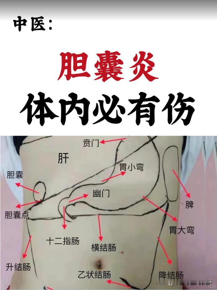 胆囊炎，不仅仅是胆囊的问题，体内必有伤

胆囊炎，看似仅是胆囊部位的炎症、感染或