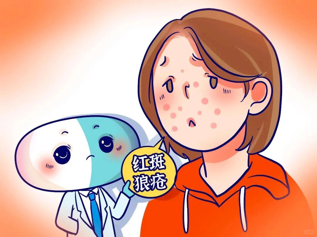 一张图教你判断，红斑狼疮！