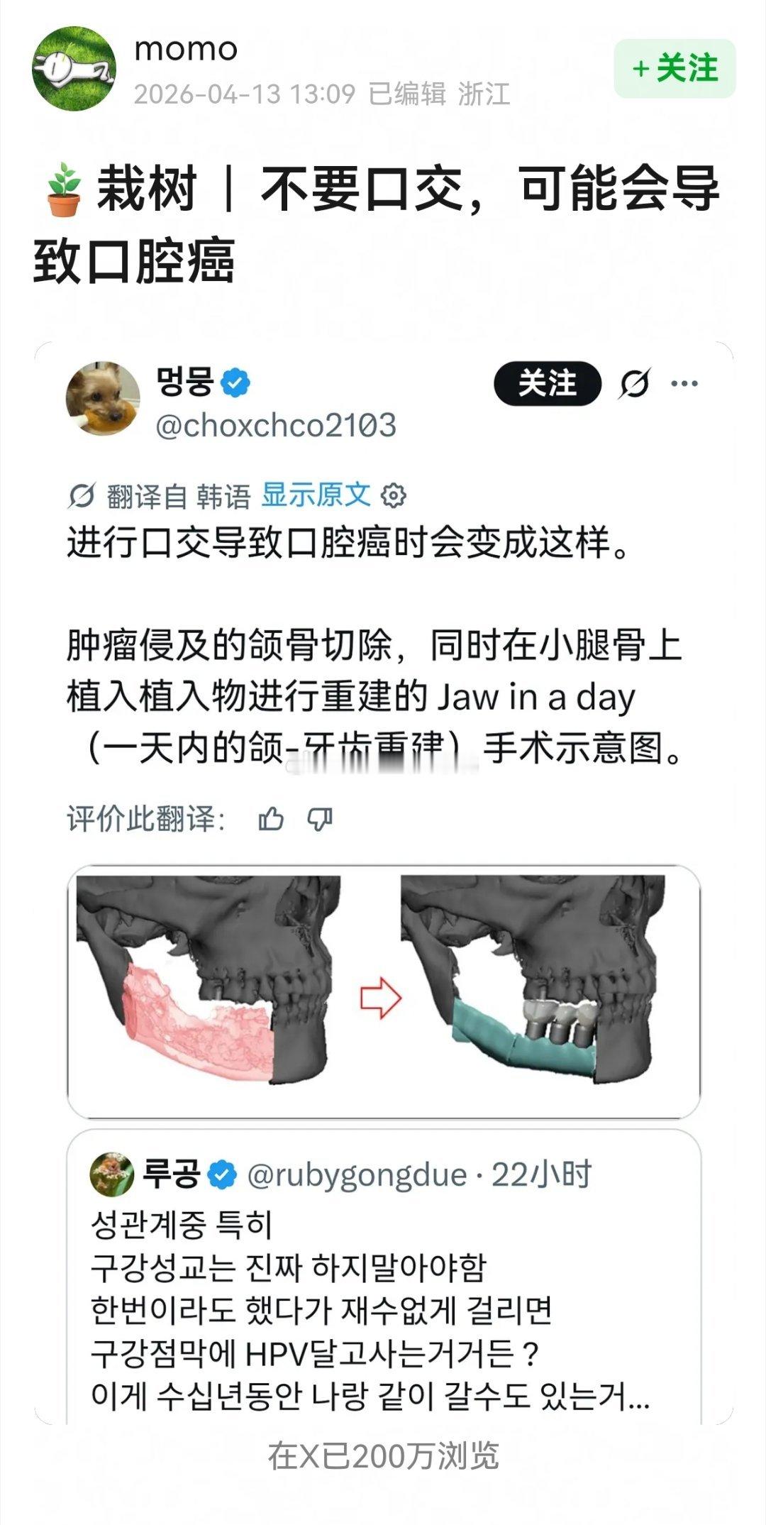第一次→不要口～交，可能会导致口腔癌～