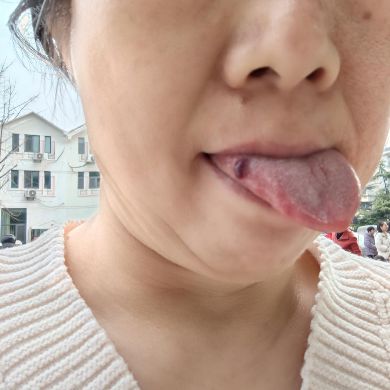 什么鬼东西，把我舌头整个大血泡！

多些年没吃零食了，今天心血来潮买了十个这样的