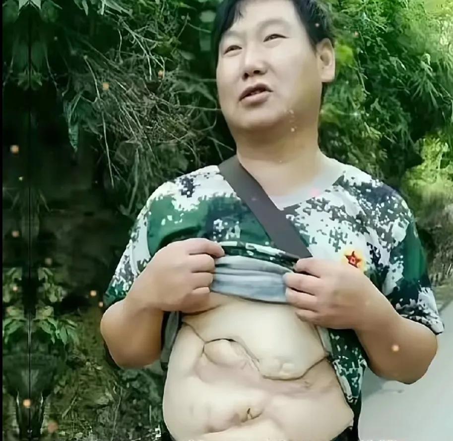 请不要吝啬您的双手，为老山英雄一等功臣雷毅点赞！
1984年5月，老山前线，雷毅