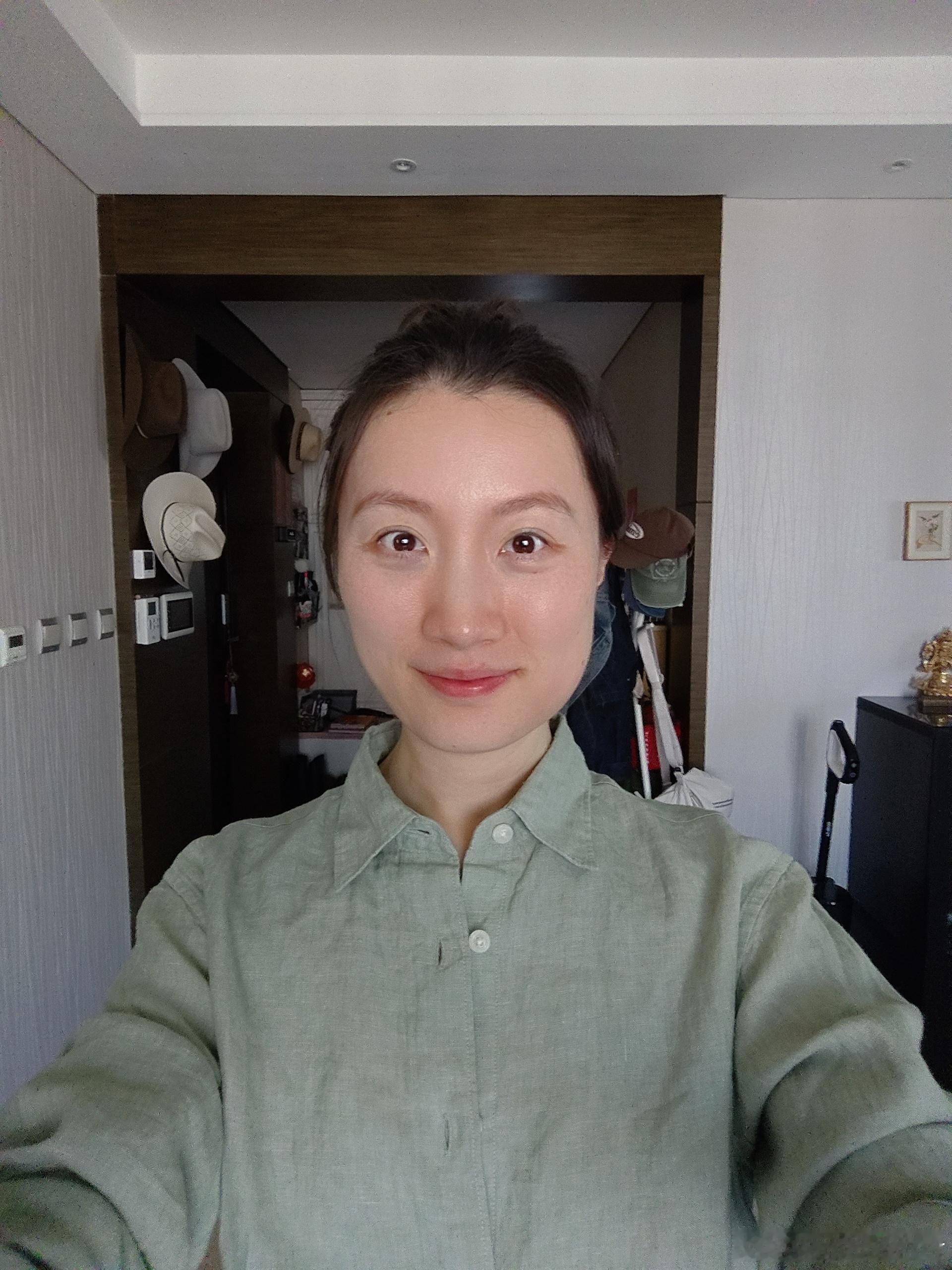 汇报一下今天没有更肿 但也没消