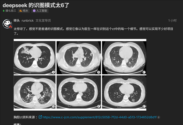 【DeepSeek能读懂CT图了】DeepSeek V4发布才5天，几乎每天都有