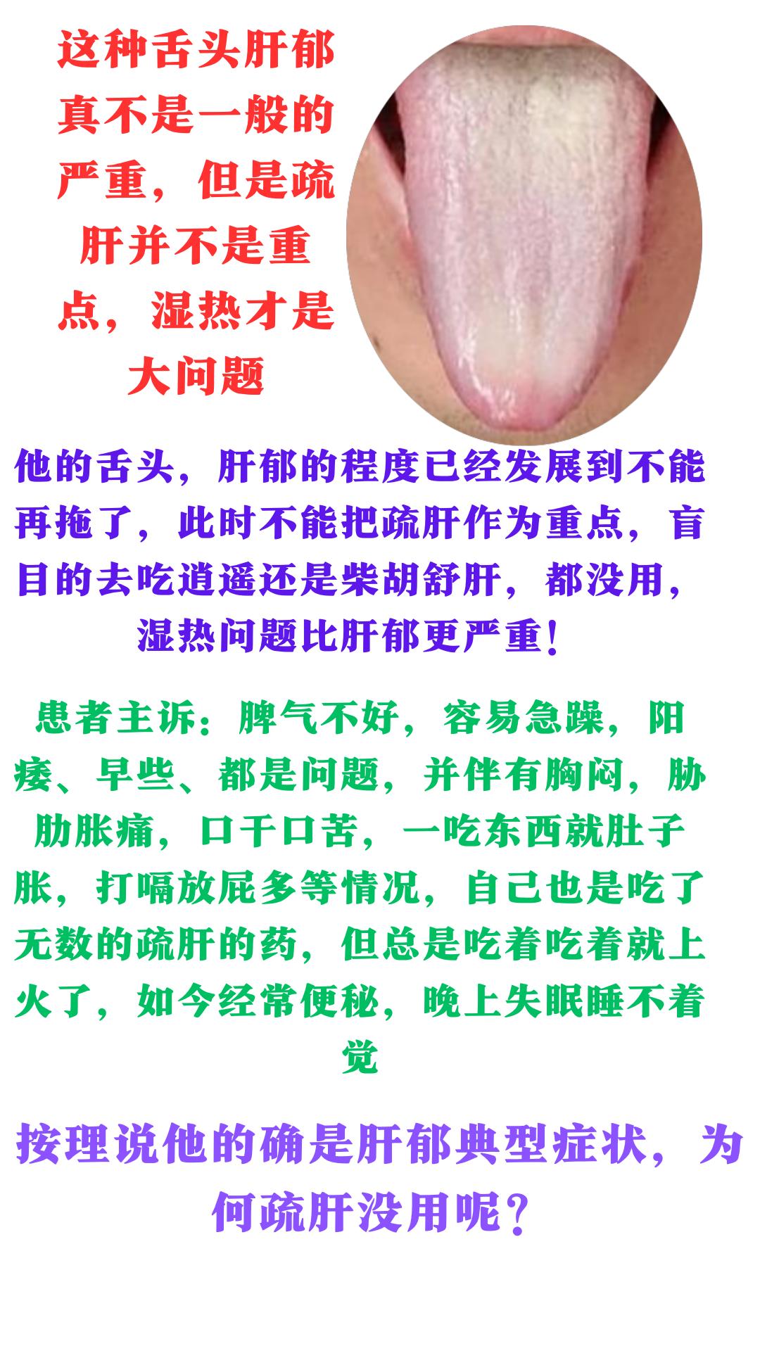 这种典型的三角舌，舌苔厚腻，白里面透着黄，肝气郁结，身体内的痰湿已经开始化热了，