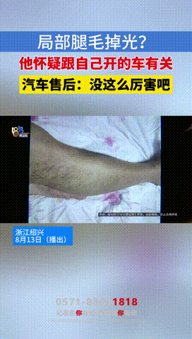 “这下解释不清了！”浙江诸暨，男子驾驶新能源车1年后，忽然看到自己两条腿上本来茂