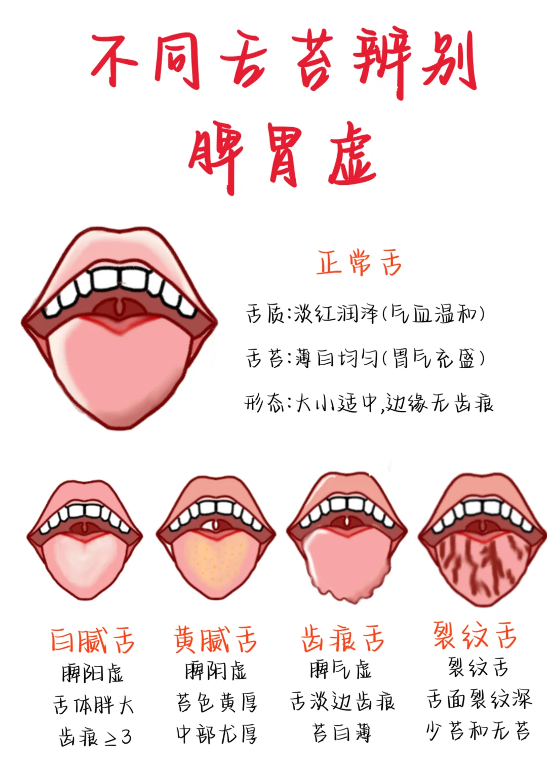 医学生笔记——舌苔辨别脾胃虚
