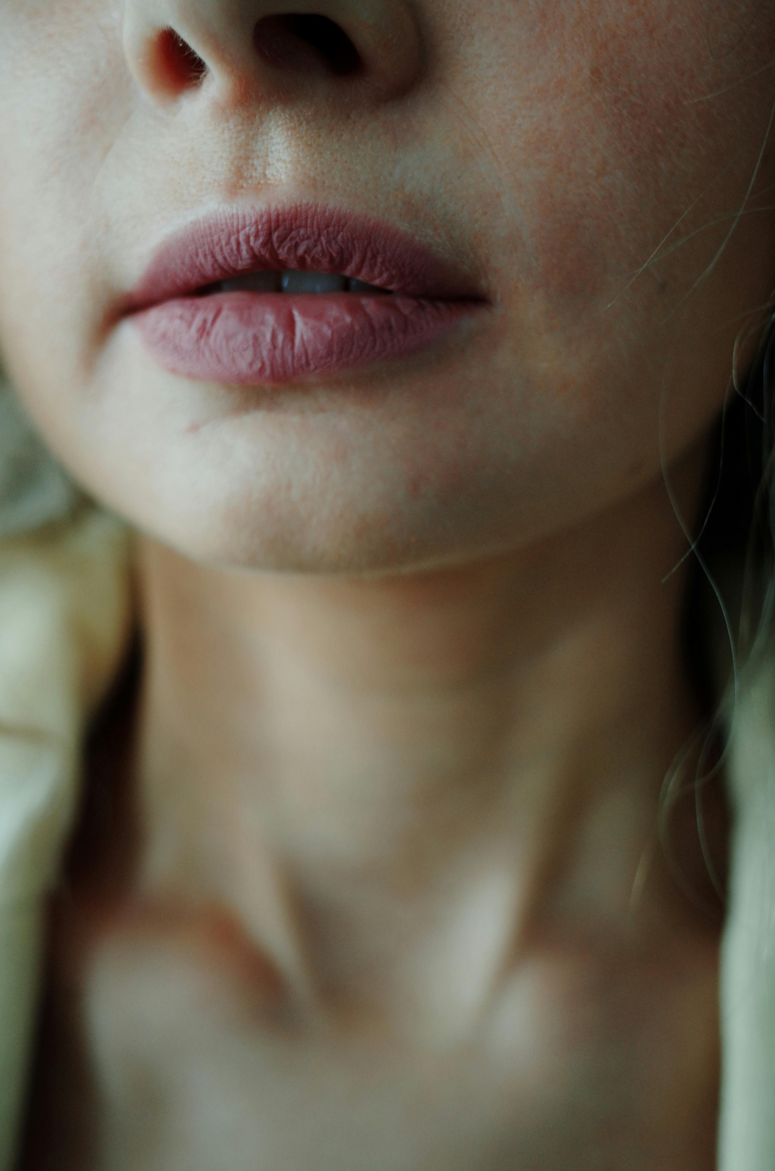 医生分析黄子韬嘴唇发紫原因 部分人唇色天生偏紫，与局部血管分布密集、表皮薄透或色