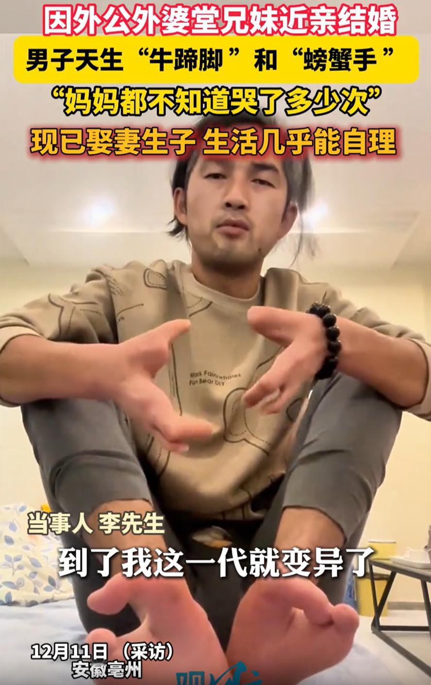 安徽亳州，外公外婆近亲结婚，本来妈妈这一代还好，没想到，到了外孙这一代却突然变异