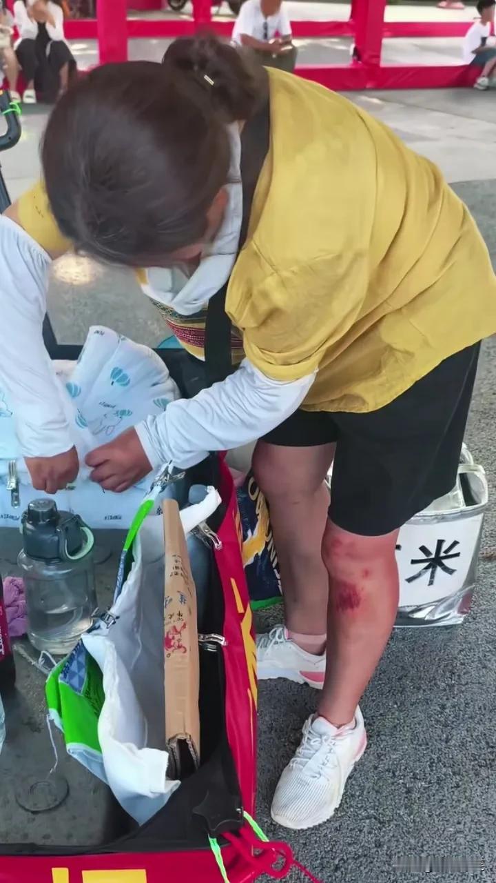 青岛“玉米大姐”，腿上的伤还没好，红通通的一片，大姐也没舍得买个创可贴贴上。

