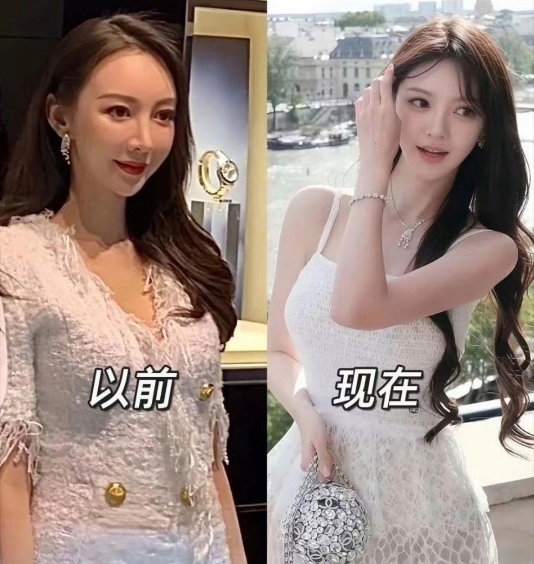 叶珂又变样了网友发的对比图估计很多人已经记不清她原来的样子了感叹现在医美技术之发