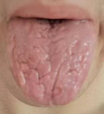 精血充盈养筋脉，中医调理男性体虚乏力







多数男性出现功能问题主要还是