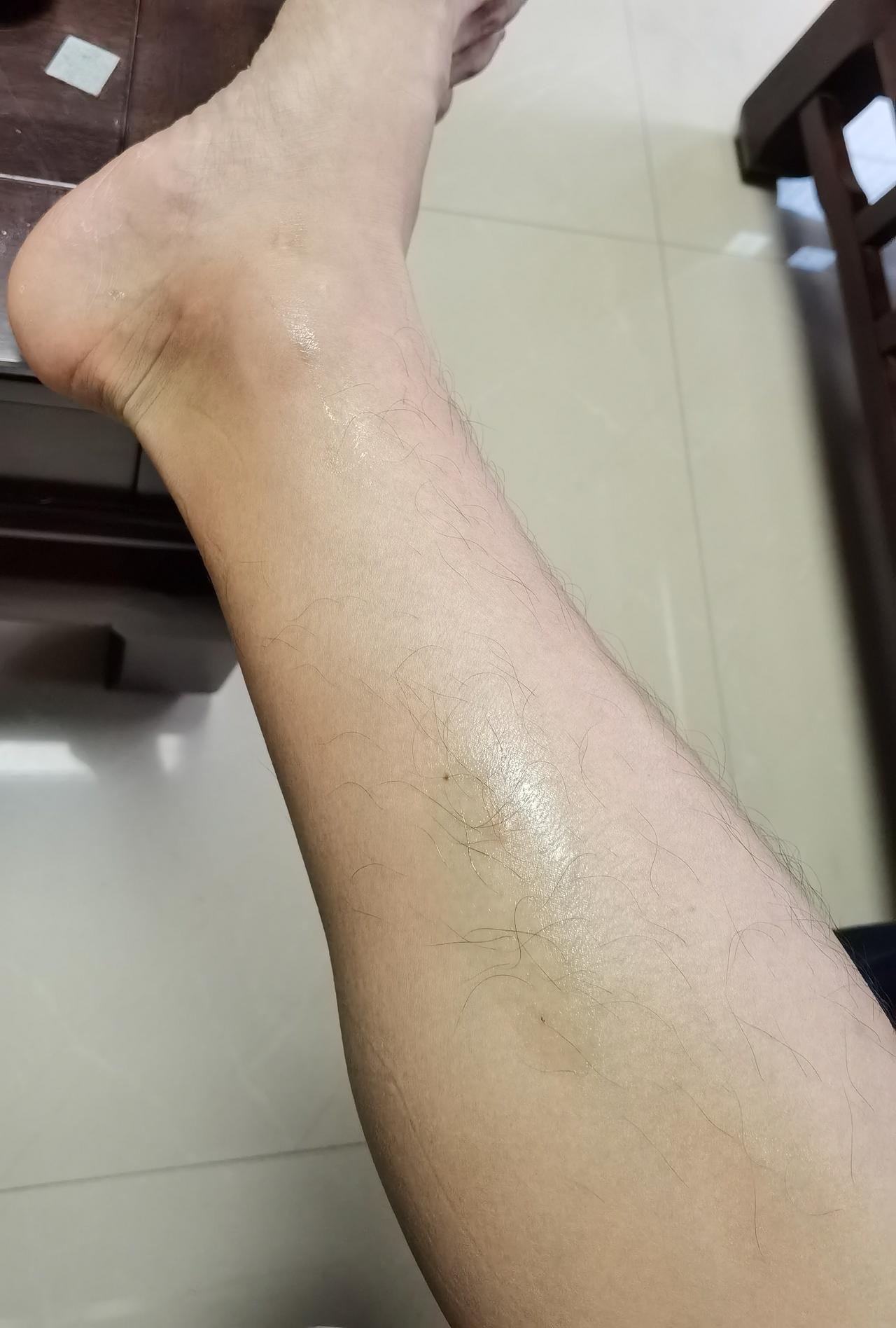 最近听说被蚊子咬多了也可以投诉！
本人要投诉三水云东海水韵公园的蚊子，
今天下午