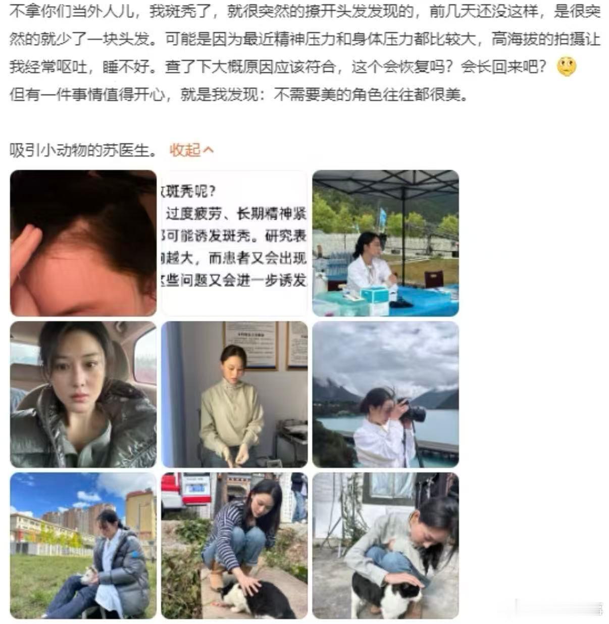娜扎自曝斑秃过 谁能想到，娜扎那一头让人羡慕的秀发，也曾经历过斑秃的小插曲。她在