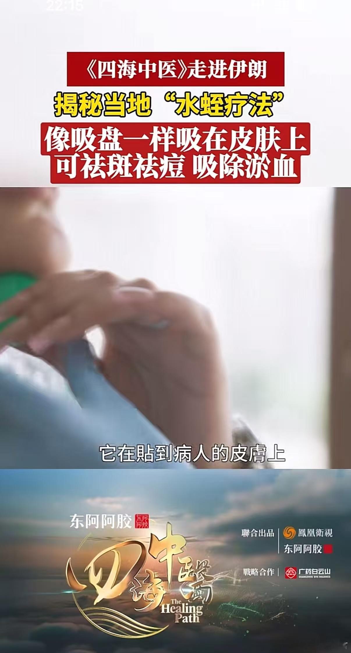 老祖宗的养生智慧绝了《四海中医》就像一扇窗，让我们看到中医药在世界舞台的精彩表现