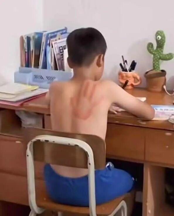 童年的伤疤，成长的印记。