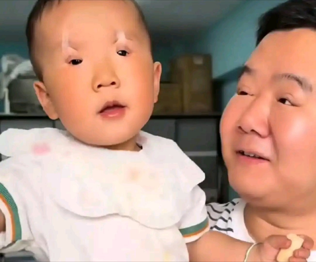 男孩出生时先天性小眼综合征每天坚持贴胶带拉伸眼皮，已经坚持506天了从不配合到现