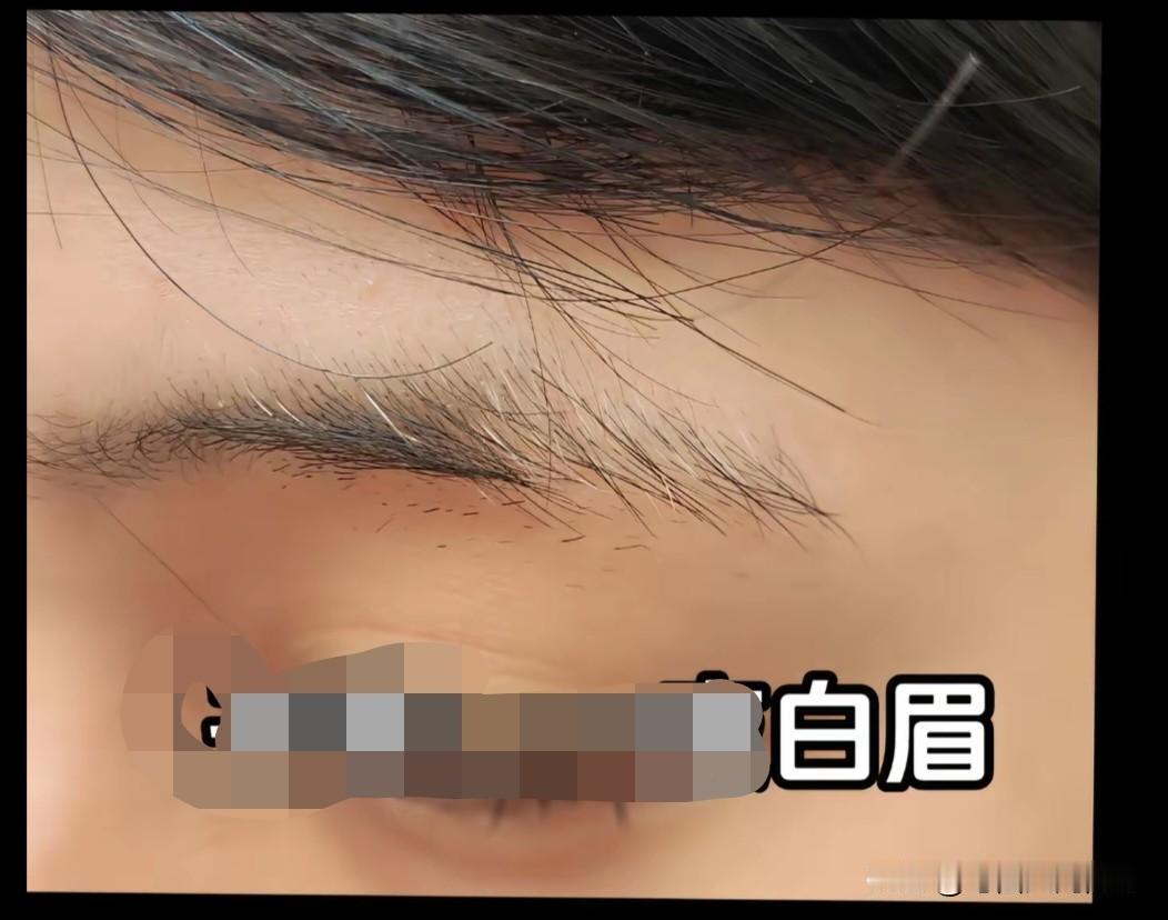 有些玄学，科学真的无法解释。
自从左眉长了根白毛后，便祸事连连。

我不知从什么