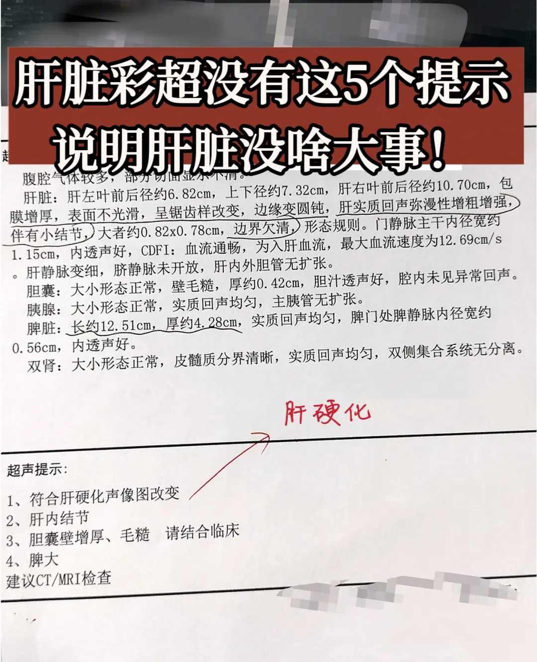 肝脏彩超没有这5个提示，说明没啥大事！比如这个彩超单子，提示：肝包膜增...