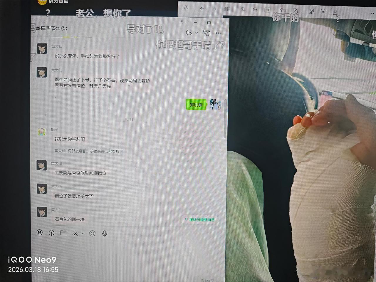 瓜友速报 北笙说黄超的手指头关节骨折了 