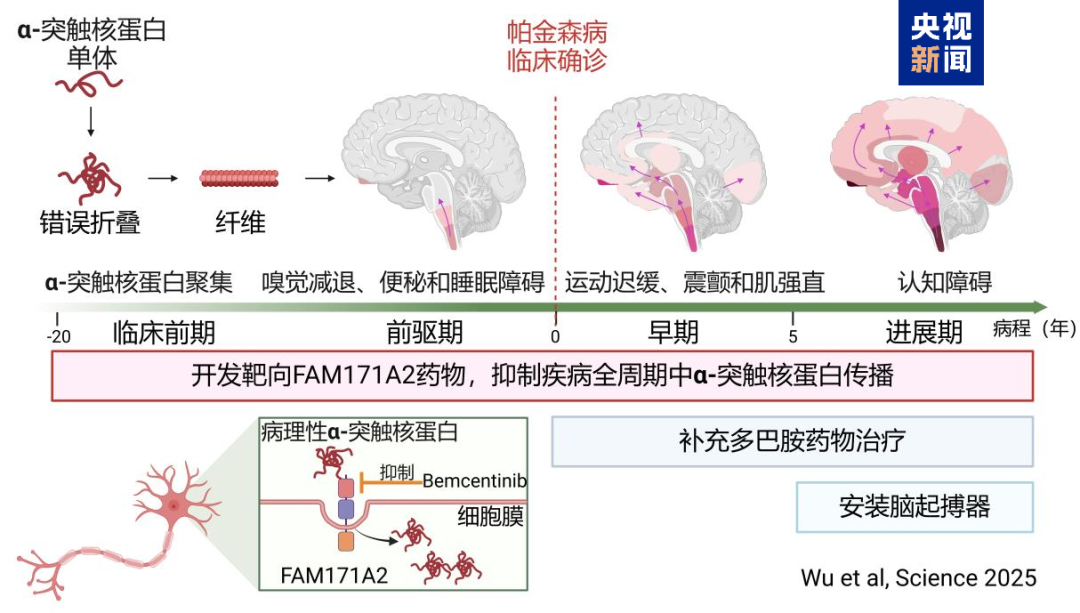 【我国科学家发现帕金森病治疗新靶点】 科技新突破   2月21日据新华社报道，国