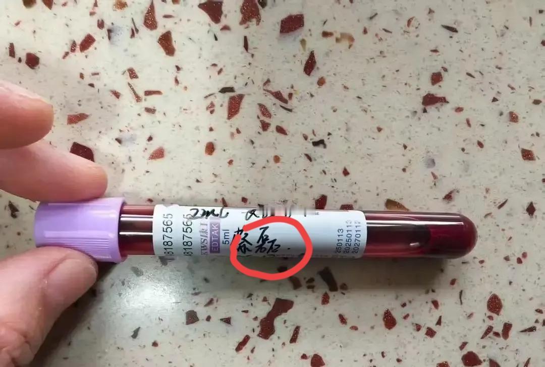 蔡磊把自己彻底“解剖”了。

国内第一份渐冻症“完美”基因组，T2T级测序。这哪