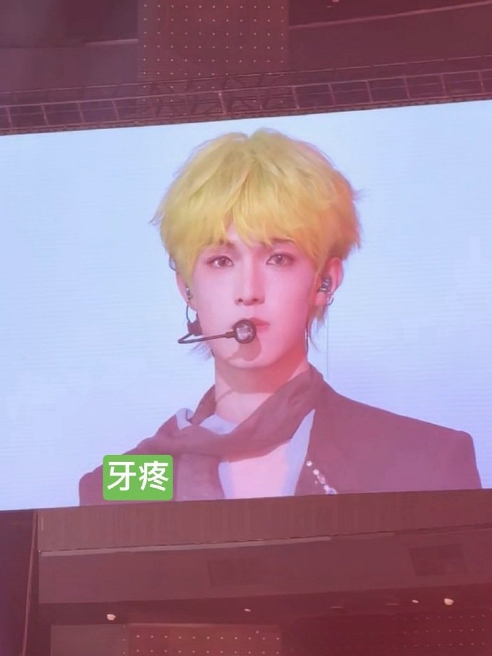 张泽禹荧光绿发色张泽禹绿发 张泽禹绿发，这个荧光绿发色和张泽禹太搭了！ 