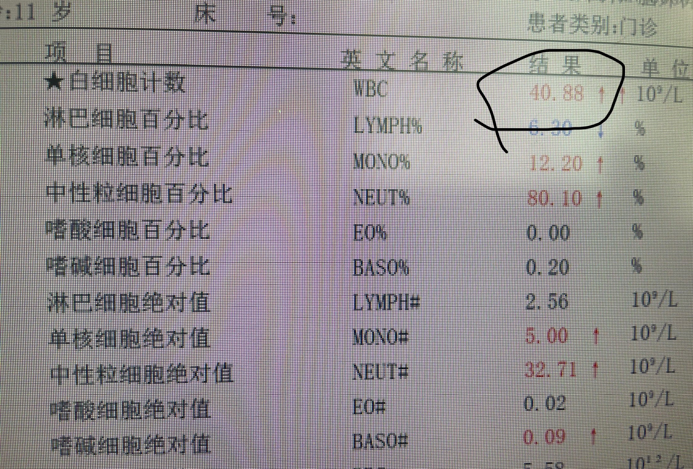 这孩子刚来的时候，只要检验结果一出来，办公室的电脑就一闪一闪报危急值病情那么重，