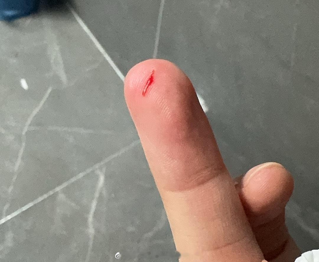 以为美缝翘边了，按了一下没按进去，给手割破了。。。疼晕(・_・)ヾ 